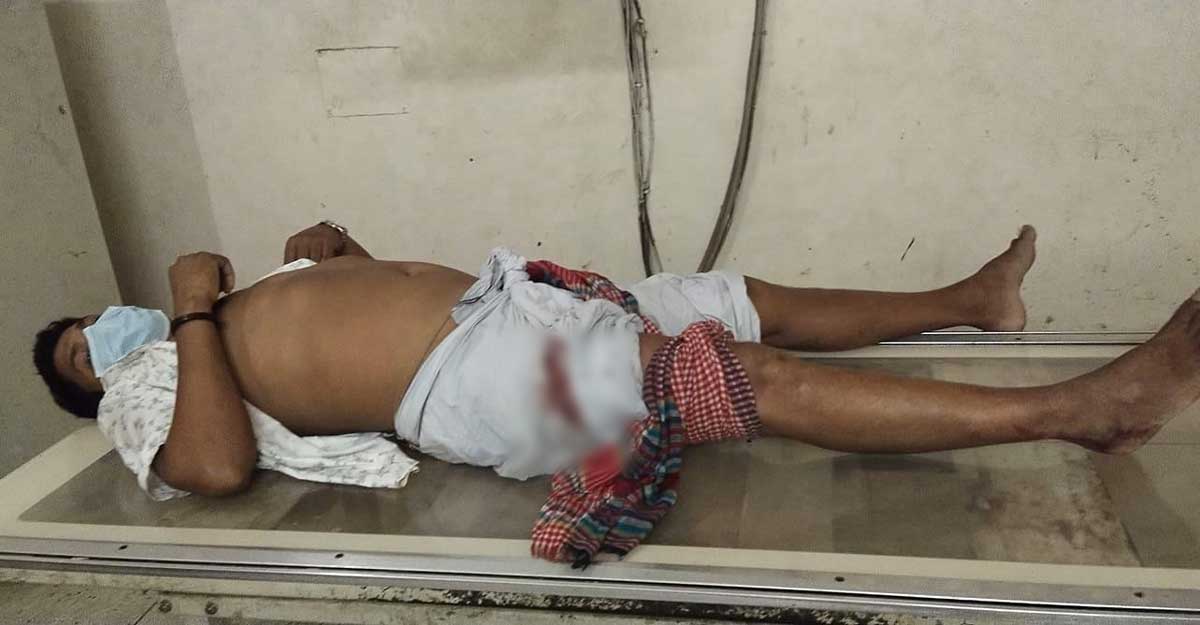 চাঁদা না দেওয়ায় ঠিকাদারকে ইয়াবা ব্যবসায়ীদের গুলি