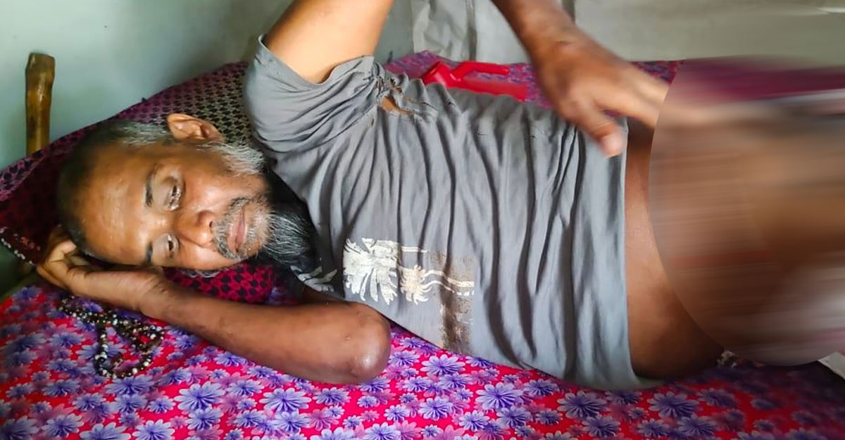 শরীরে ধরেছে পচন, বিনা চিকিৎসায় মরতে চান না হুমায়ূন