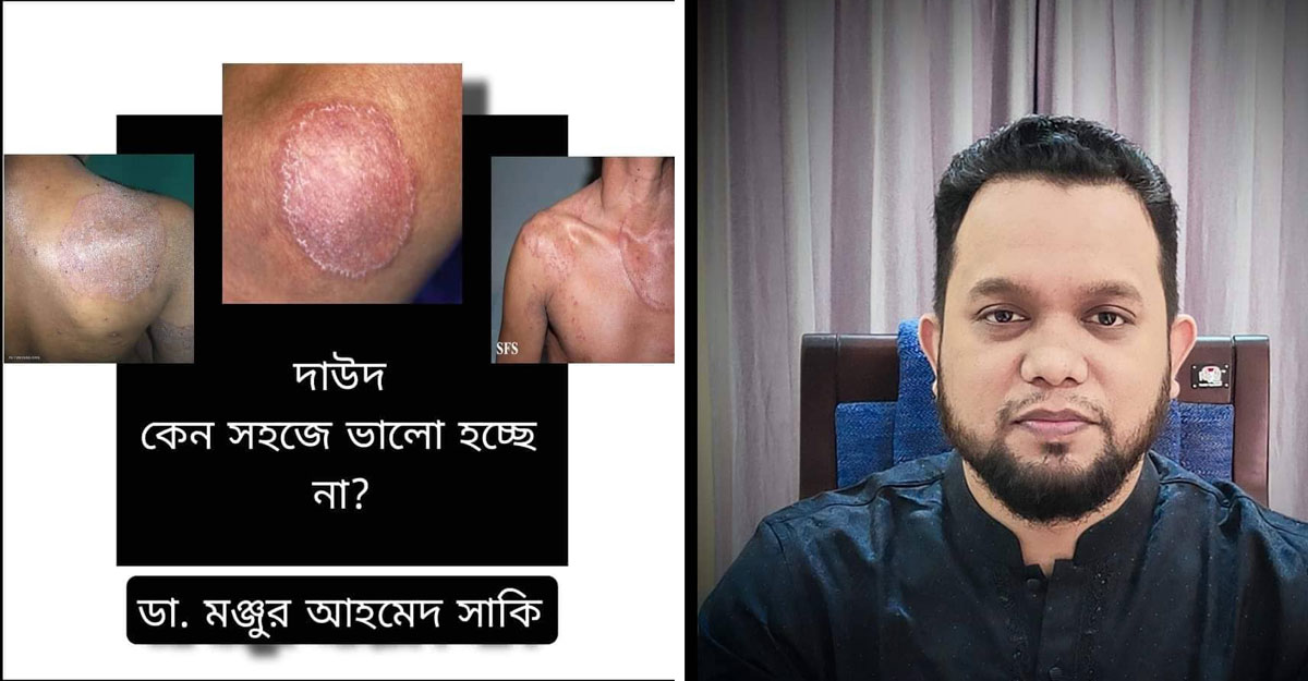 দাউদ থেকে উত্তরণের উপায় কী?