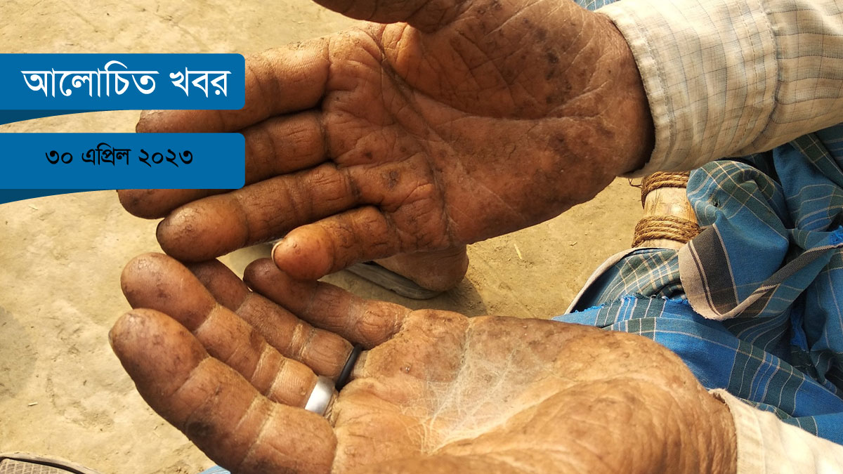 তিন মাসে আট হাজার আর্সেনিক রোগী!