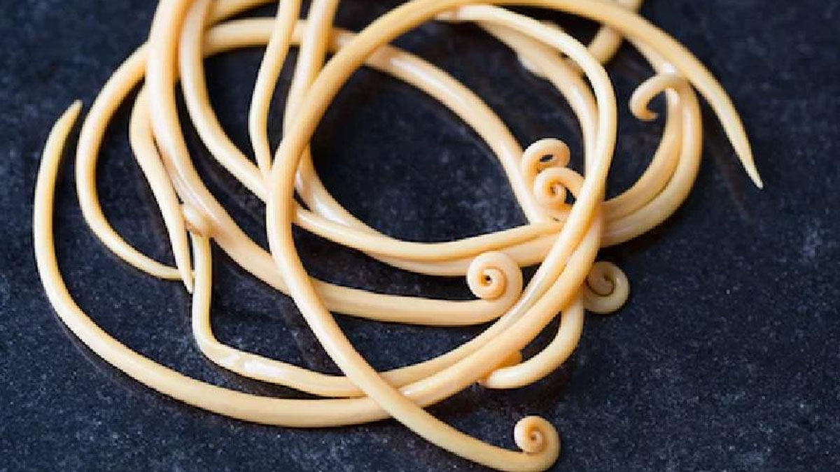 ওষুধ ছাড়াও কৃমি কমতে পারে যেভাবে