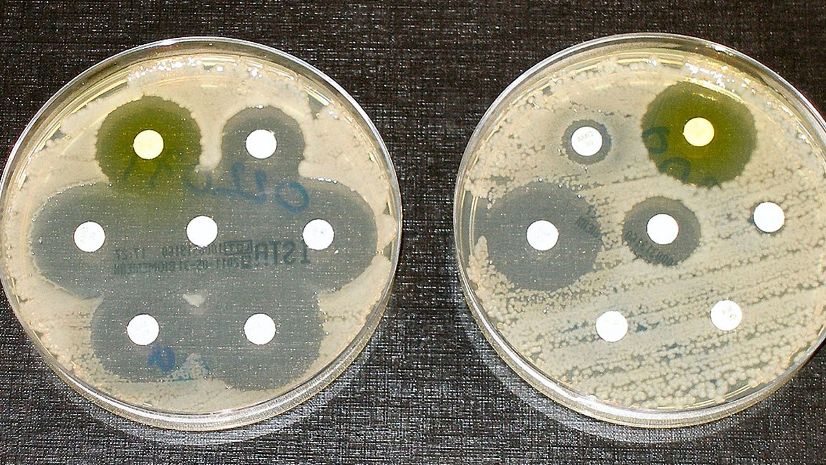 অ্যান্টিবায়োটিকের যথেচ্ছ ব্যবহার যে বিপদে ফেলতে পারে মানুষকে