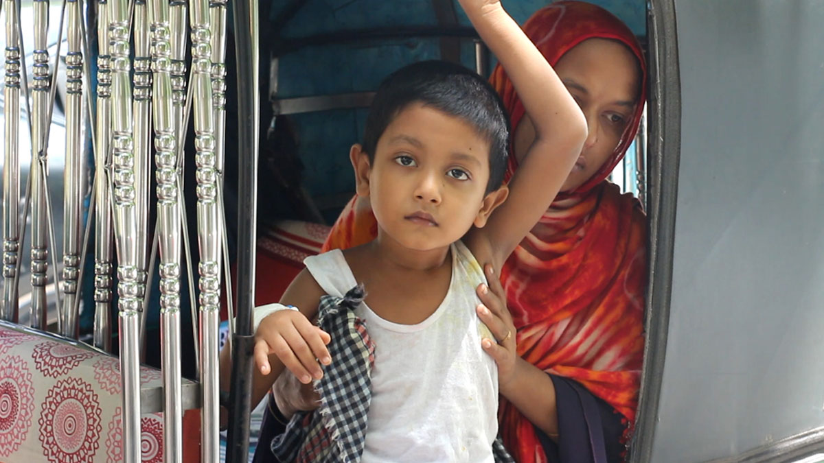 শেবাচিমে গলার সমস্যায় ভর্তি হওয়া শিশুর অস্ত্রোপচার হলো তলপেটে