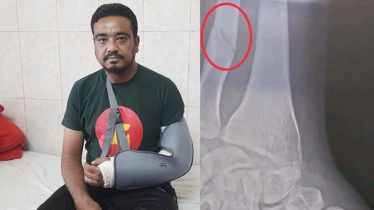 ওসির বিরু‌দ্ধে যুবলীগ নেতাকে পি‌টি‌য়ে হাত ভেঙে দেওয়ার অভিযোগ