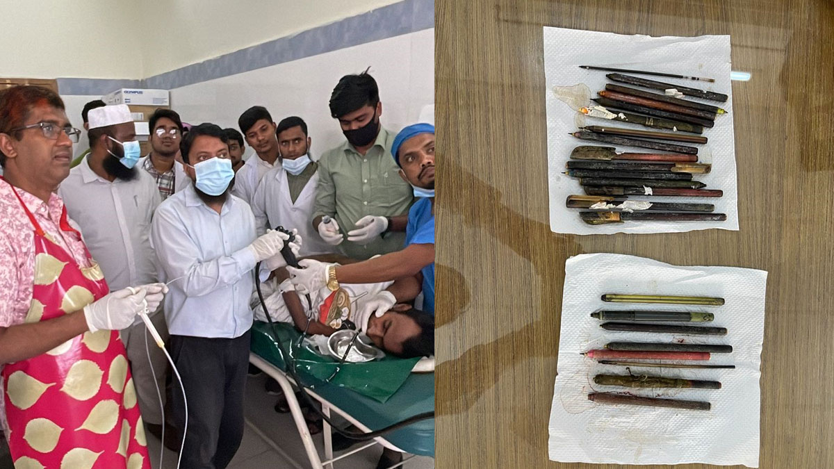 সেই মোতালেবের পেট থেকে বের করা হলো আরও ৮টি কলম