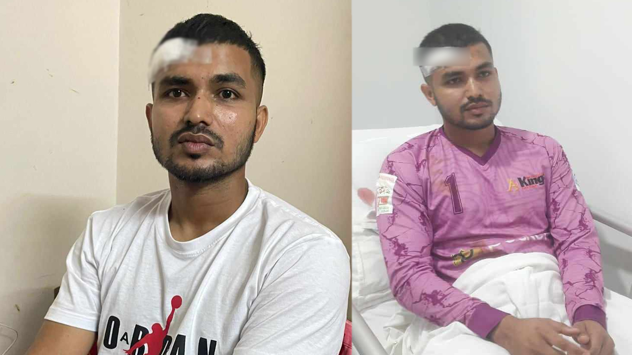 কসমেটিক সার্জারির পর ক্লাবে ফিরলেন জিকো