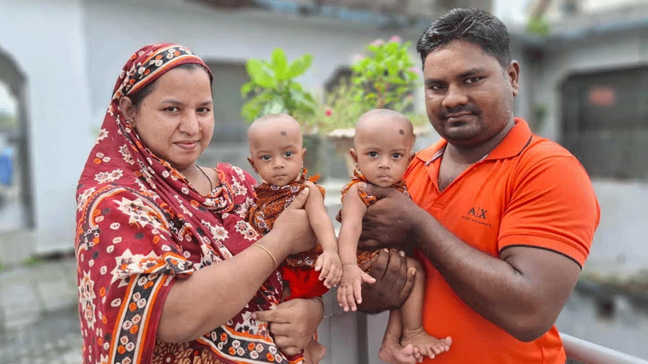 ৪ ঘণ্টার লড়াইয়ে আলাদা হলো যমজ, রিকশাচালকের দুই কন্যা পেল নতুন জীবন