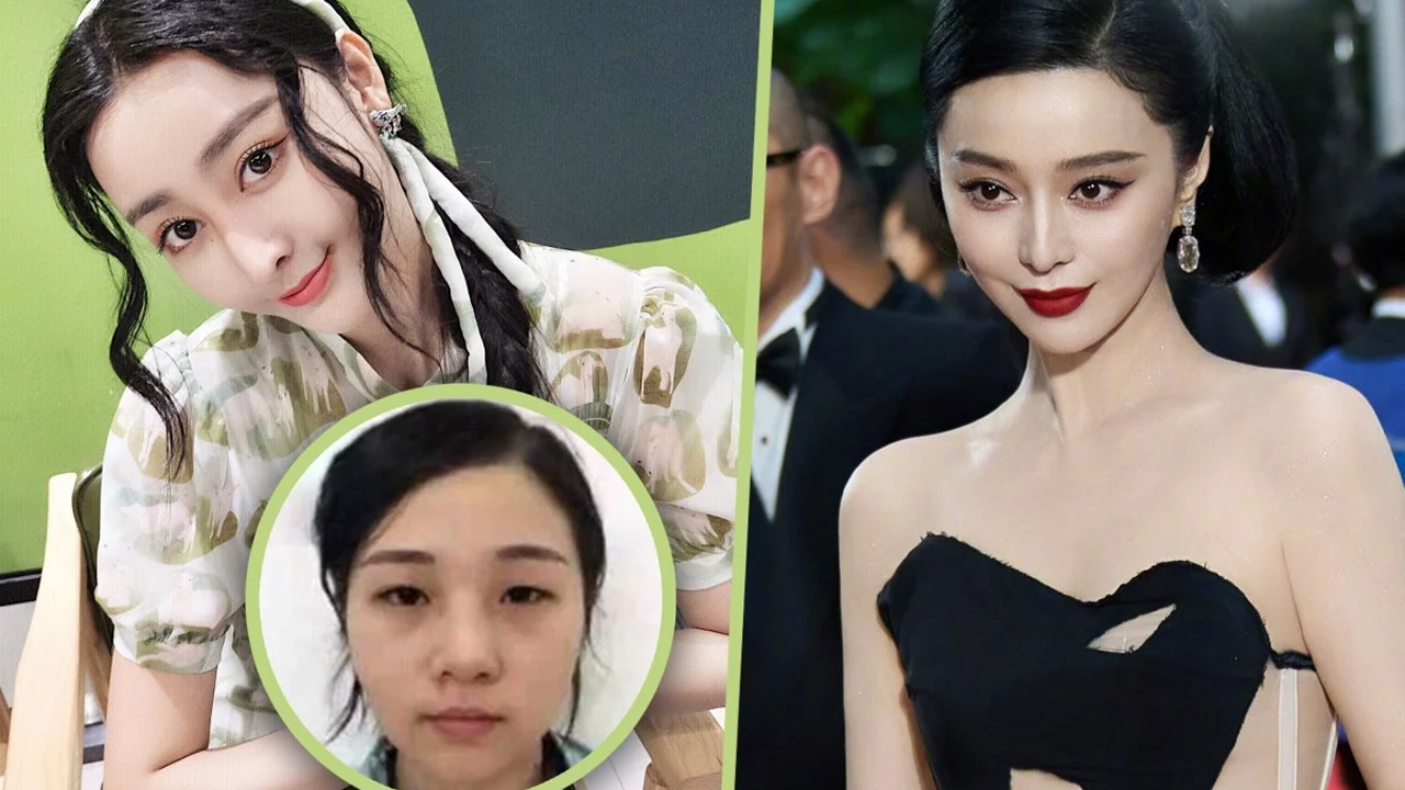 ১২ কোটি খরচে অভিনেত্রীর মতো চেহারা করে বিপদে তরুণী