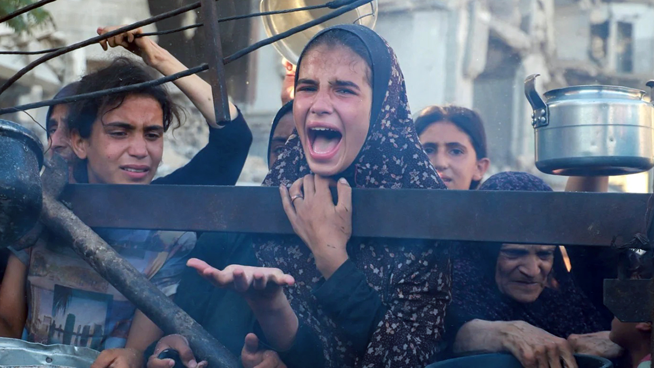 গাজায় আশঙ্কাজনক হারে বাড়ছে অপুষ্টির মাত্রা