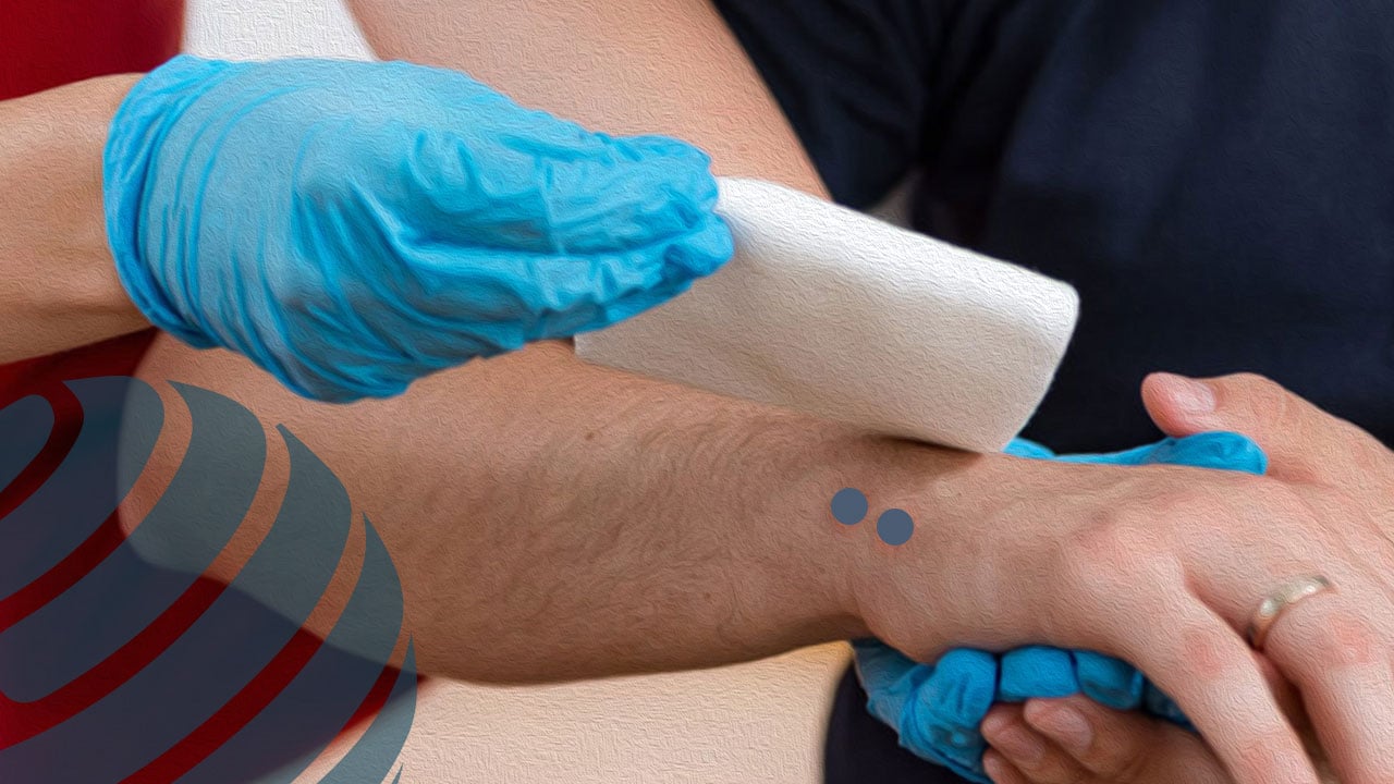 চিকিৎসার অভাবে সাপের কামড়ে প্রাণহানি বাড়ছে