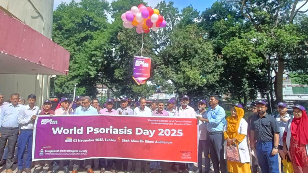 সোরিয়াসিস শুধু চর্মরোগ নয়, এটি রোগের সমাহার