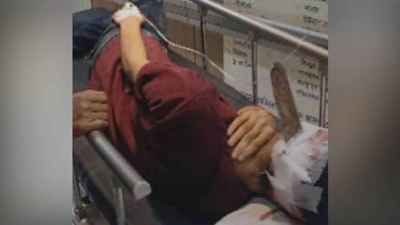 জাবিতে ঘাস কাটা মেশিনের ব্লেড ভেঙে ঢুকল যুবকের মাথায়