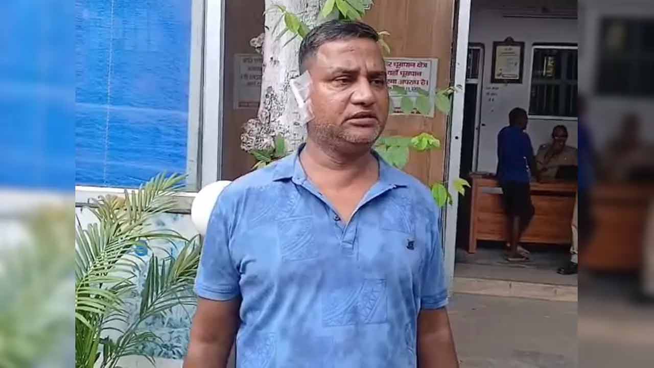 দাম্পত্য কলহের জেরে স্বামীর কান কামড়ে ছিঁড়ে নিলেন স্ত্রী