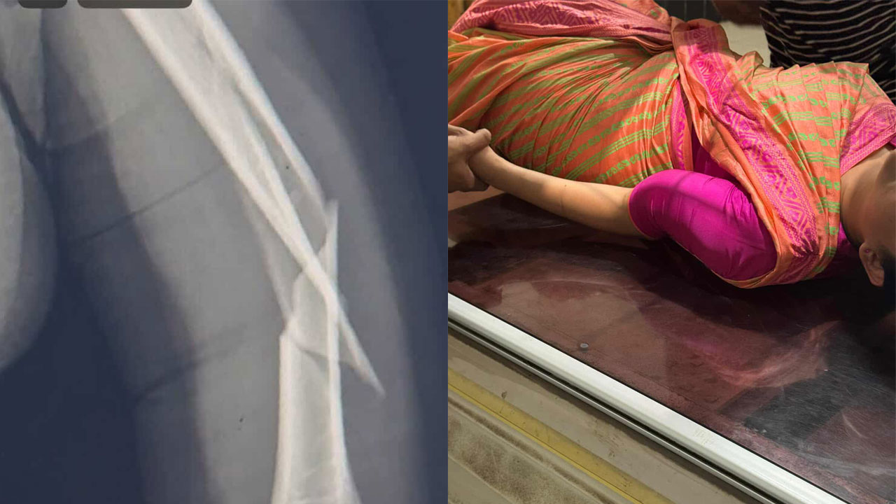 মাঝ আকাশে হাত ভাঙলো বিমানের কেবিন ক্রুর