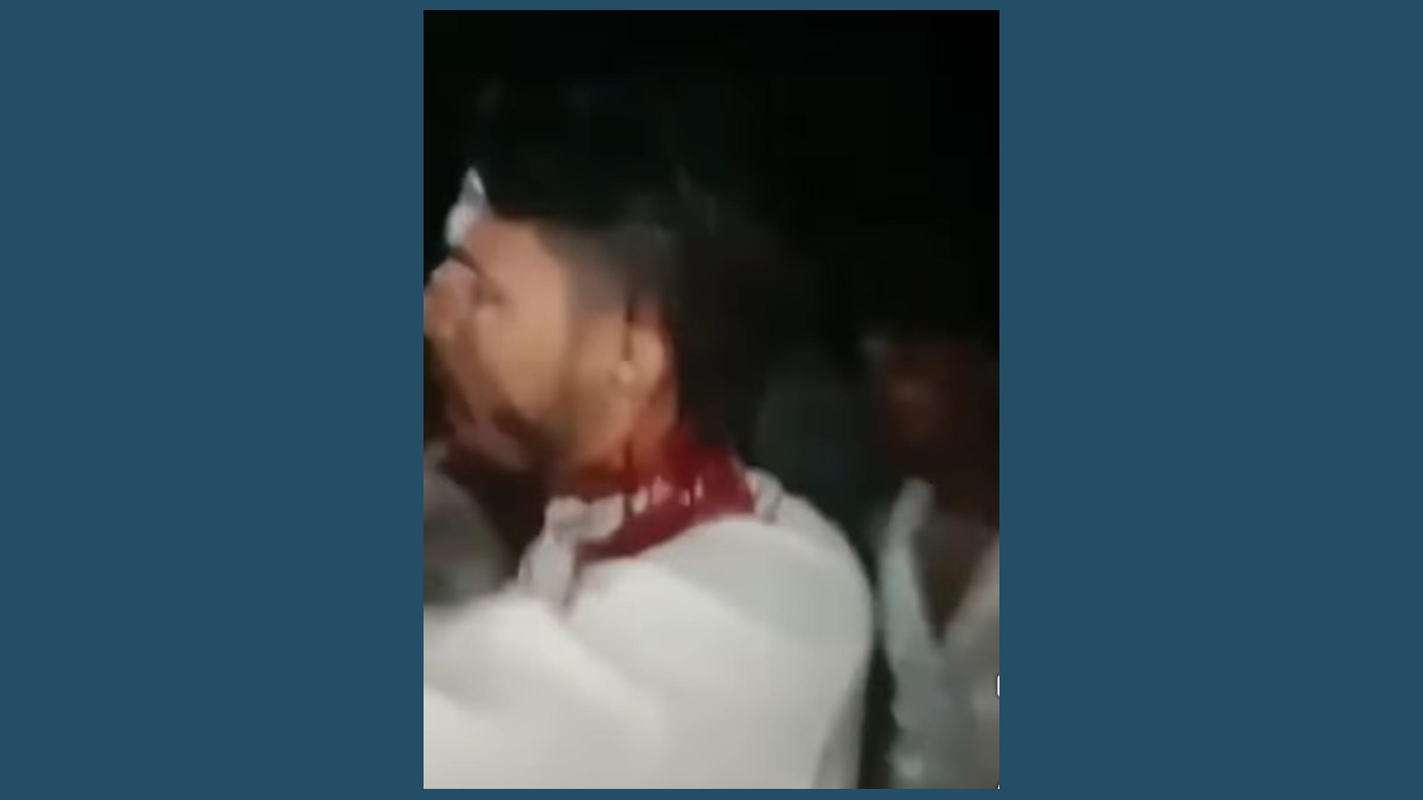 চট্টগ্রা‌মে বিএনপি-জামায়াত সংঘর্ষ