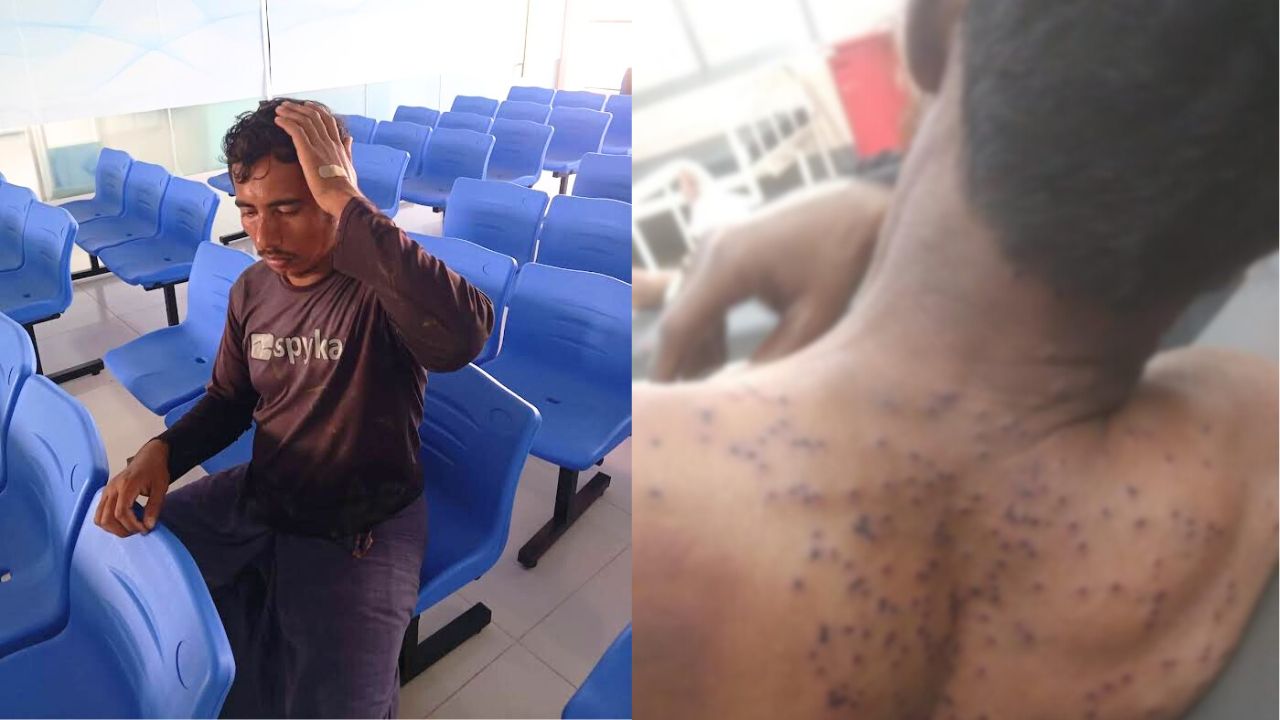 বঙ্গোপসাগরে ৩ ট্রলারে জলদস্যুদের হামলা, গুলিবিদ্ধসহ আহত ১১ মাঝি