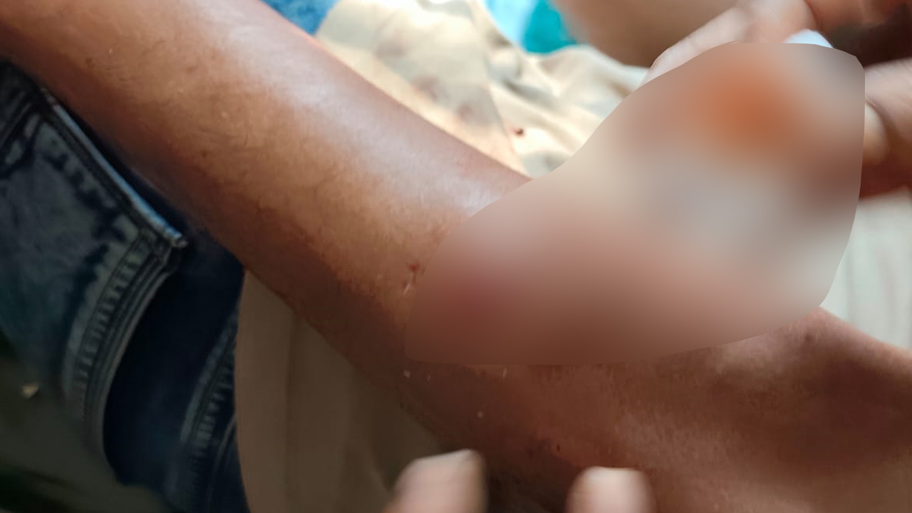 ফরিদপুরে যাত্রীবাহী বাস খাদে পড়ে আহত ১৭